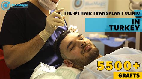Cost of getting Blue magic hair transplant in Turkey